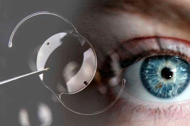 Cirug&iacute;a L&aacute;ser para altas ametrop&iacute;as